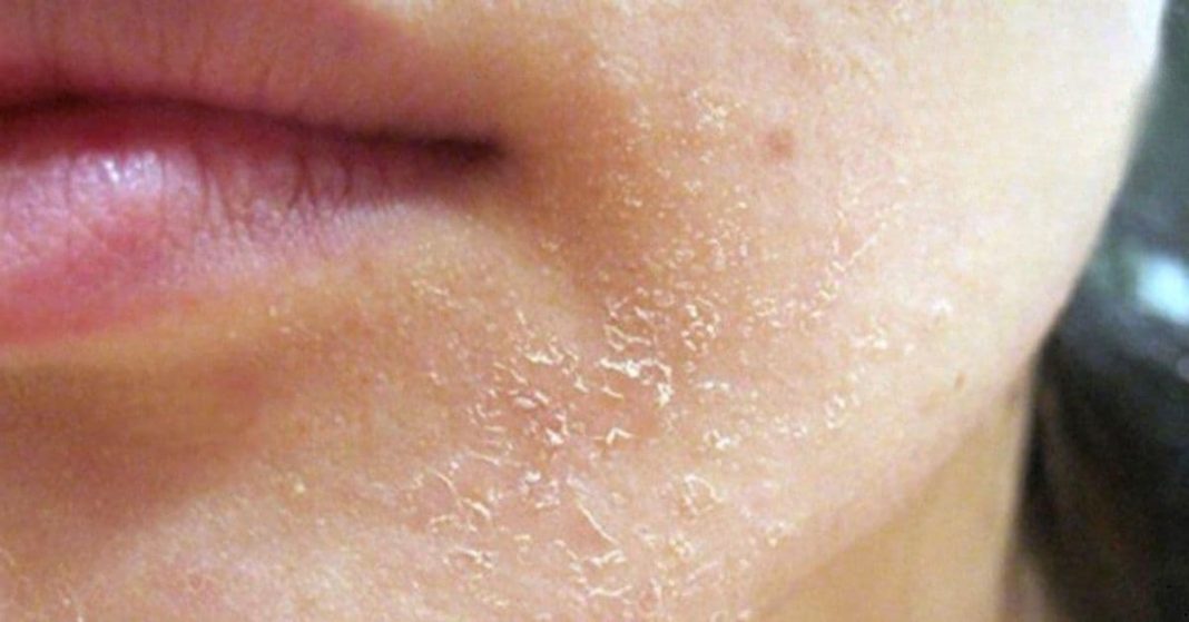 How the body asks for help How the body asks for help