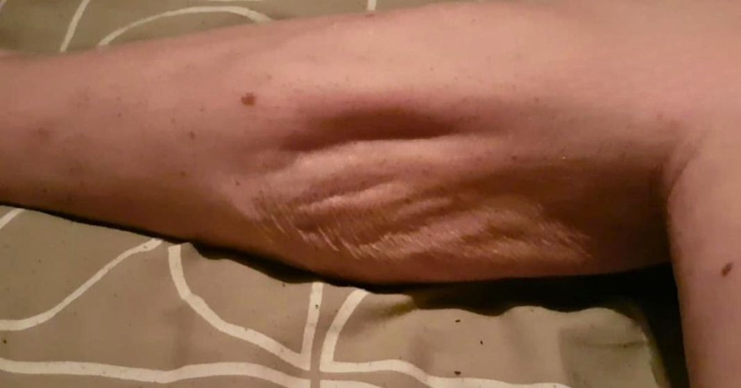 dangerous signs of low magnesium dangerous signs of low magnesium