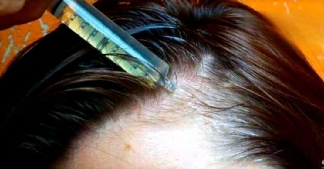reduce your risk of excessive hair loss reduce your risk of excessive hair loss