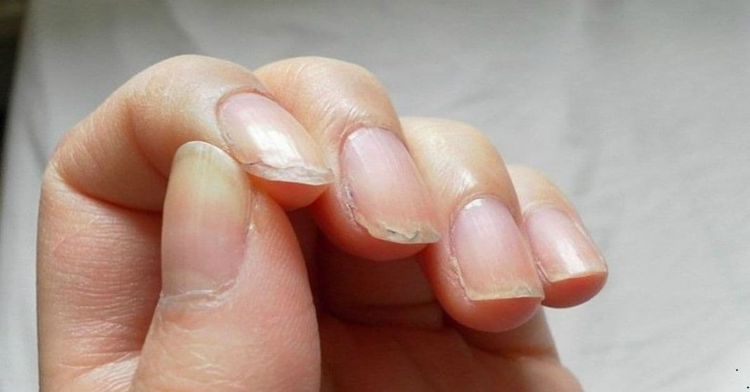 How to grow nails fast