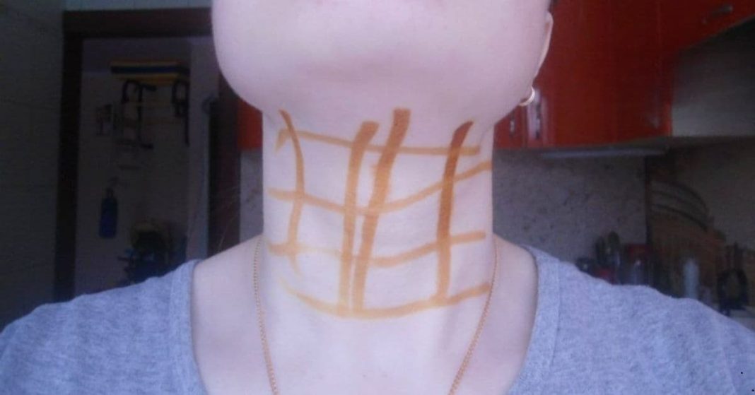 How useful is an iodine grid How useful is an iodine grid