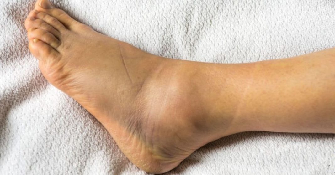 signs that indicate kidney problems