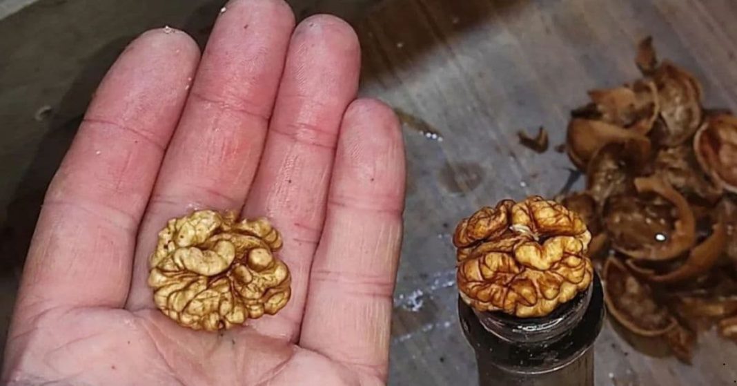 Foods for an Overactive Bladder