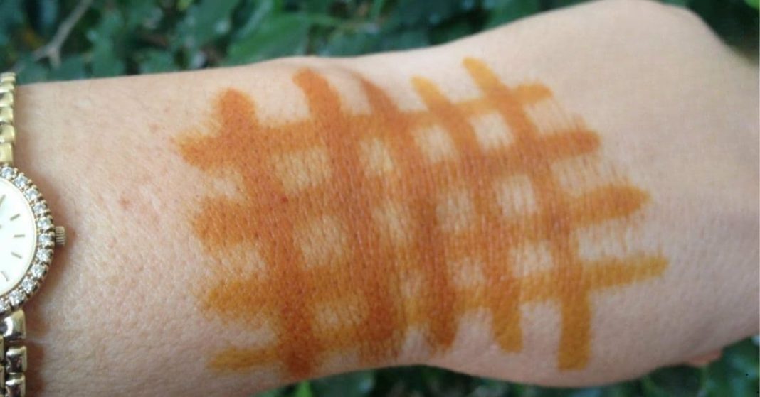 Iodine grid on the body