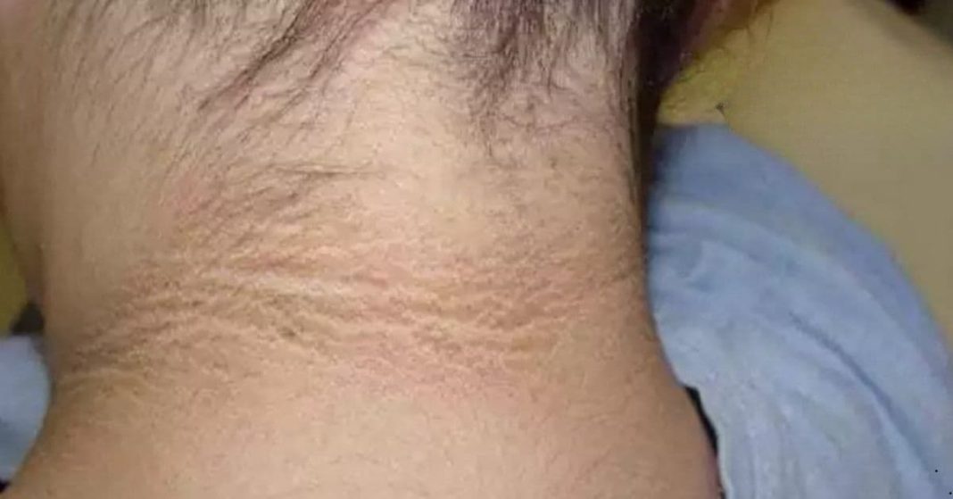 Signs and symptoms of diabetes