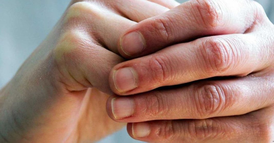 B12 Vitamin's lack's signs in the organism B12 Vitamin's lack's signs in the organism