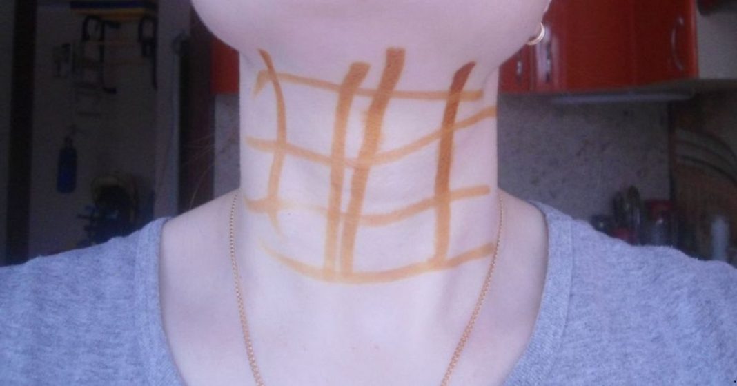 Iodine grid Iodine grid