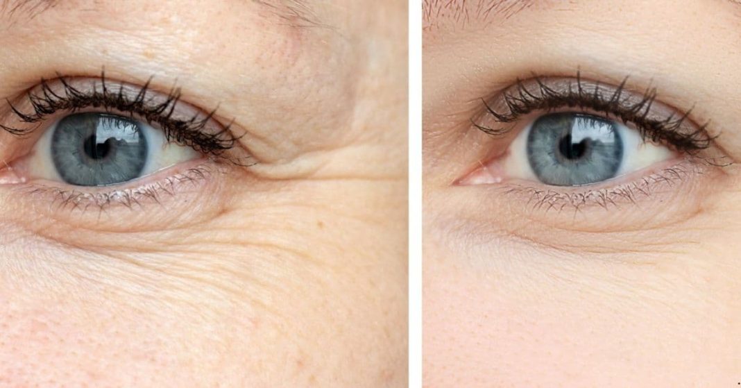 Smooth Wrinkles Naturally Smooth Wrinkles Naturally