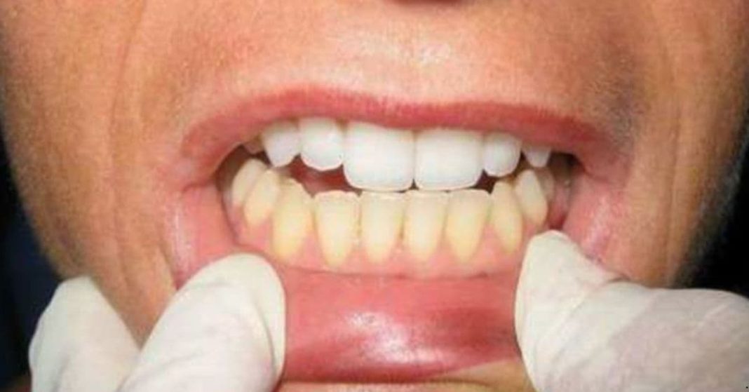 mouth rinsing remedy